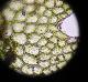 Cephalozia sp